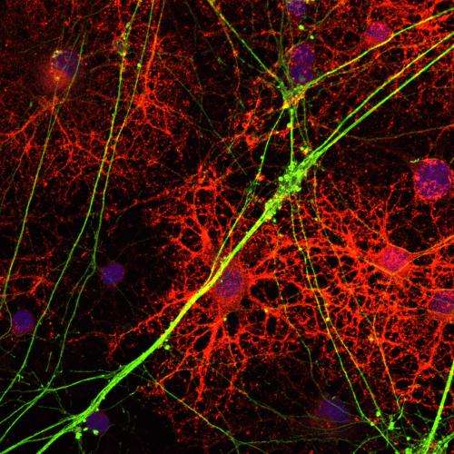New strategy to treat multiple sclerosis shows promise in mice