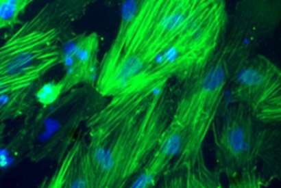 Physical cues help mature cells revert into embryonic-like stem cells