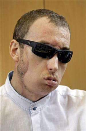 Poland's first face transplant patient goes home