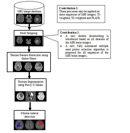 Research Highlight - Spectral Texture Segmentation of Magnetic Resonance Imaging (MRI) Brain Images For Glioma Brain Tumour Dete