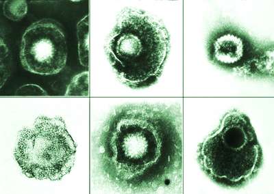 Thwarting herpes, scientists open antiviral drug path