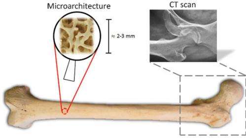 Universities develop tissue diagnostic tool to look inside patients bones