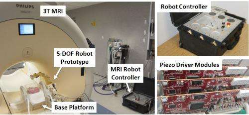 Using a robot to improve brain cancer treatment is aim of a $3 million NIH award to WPI