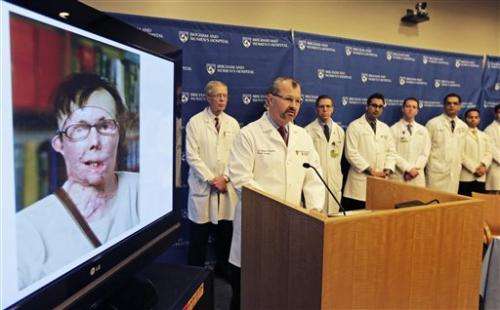 Vt. lye victim gets new face at Boston hospital