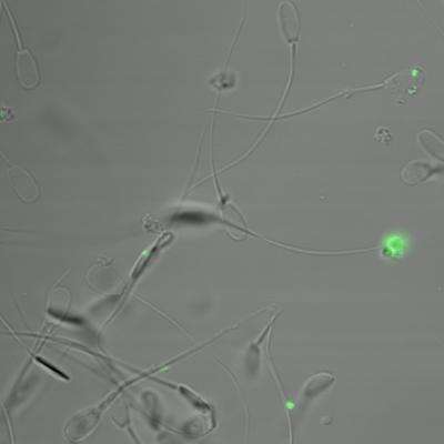 Nanoparticles to probe mystery sperm defects behind infertility