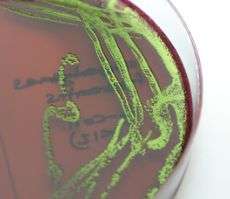New study to give insight into the public health risks of antibiotic resistant bacteria