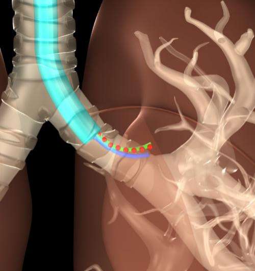 Researchers devise X-ray approach to track surgical devices, minimize radiation exposure