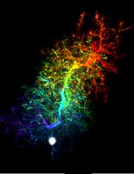 Researchers discover dynamic behavior of progenitor cells in brain
