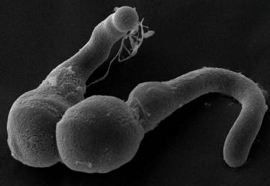 Microchip proves tightness provokes precocious sperm release