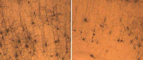 Sanford-Burnham researchers unravel molecular roots of Down syndrome