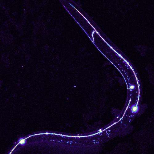 Biologists uncover details of how we squelch defective neurons