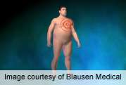 Central adiposity may blunt metabolism, worsen weight gain