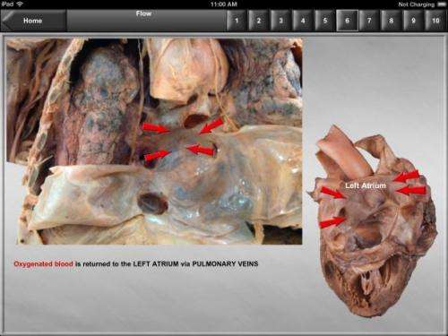 New app lets med students study real human heart on iPad