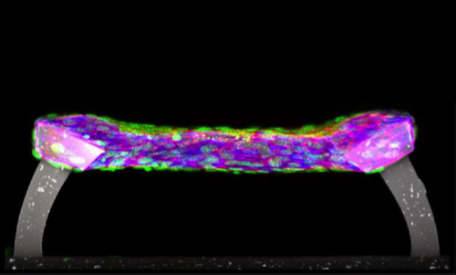 Researchers at Penn help develop a dynamic model of tissue failure