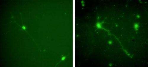 Researchers find a better way to culture central nervous cells