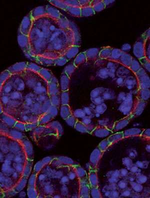 Researchers offer new insights on cancer cell signaling