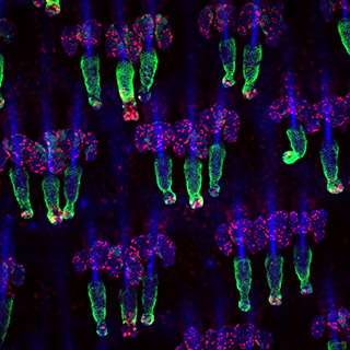 Scientists identify gene that regulates stem cell death and skin regeneration