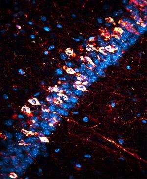 UCSB research points to a potential therapeutic approach to Alzheimer's disease