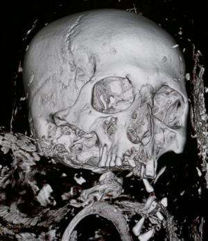 US museum unwrapping mummy's story with CT scan