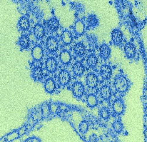 2009 pandemic flu death toll much higher than official worldwide estimates