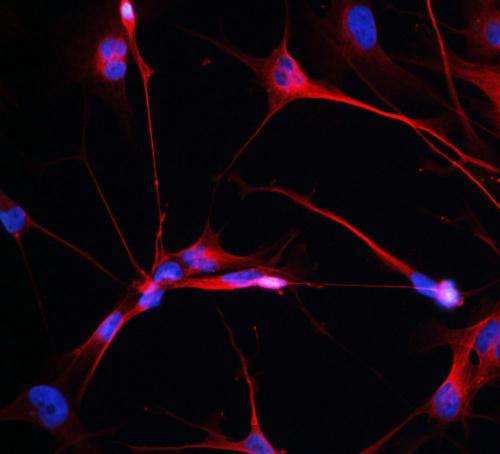 Study reveals genes that drive brain cancer