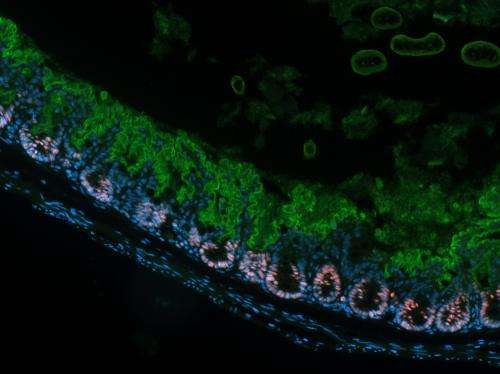 Study reveals role of 'peacekeeper' in the gut