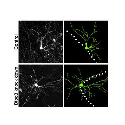 Researchers identify molecule that orients neurons for high definition sensing