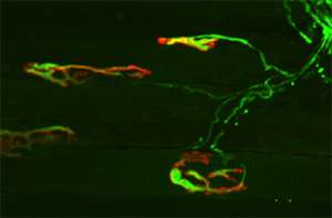 Scientists show how nerve wiring self-destructs