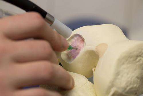 'Bio pen' allows surgeons to design customised implants