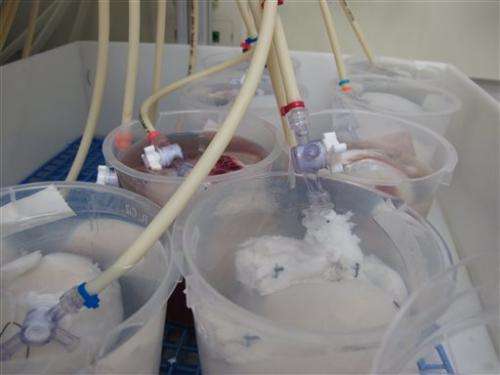 More patients getting lab-grown body parts