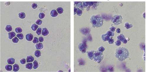 Scientists discover how leukemia cells exploit 'enhancer' DNA elements to cause lethal disease