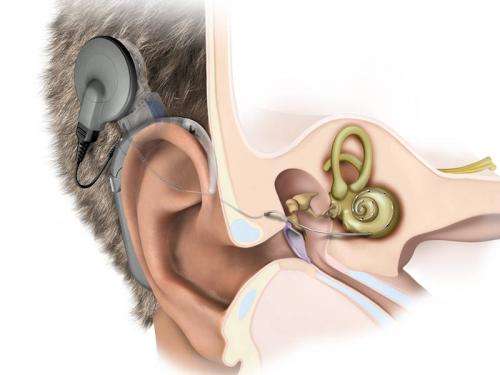 Understanding hearing