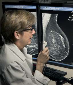 3D mammography increases cancer detection and reduces call-back rates, Penn study finds