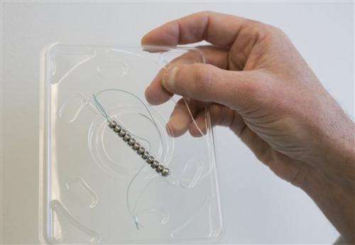 Implanted 'bracelet' helps treat chronic heartburn