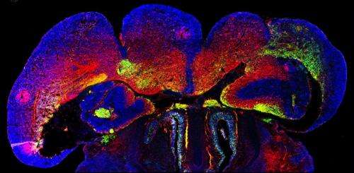 Researchers discover a gene’s key role in building the developing brain’s scaffolding