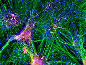 Developmental biology: How a protein collaboration builds the brain