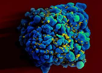 Experimental HIV vaccine targets virus envelope protein
