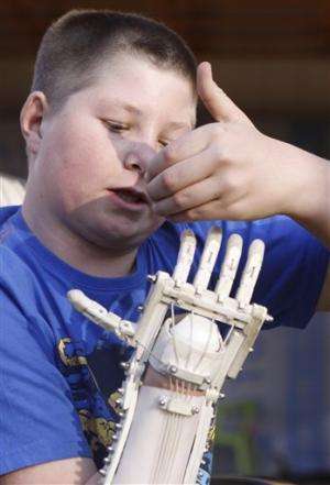 Robohand uses 3D printing to replace lost digits