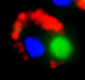 Blockade in cellular waste disposal: Scientists show how protein aggregates disrupt the molecular balance of the cell