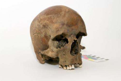 A centuries-old skull found in northern New South Wales in late 2011, in Canberra