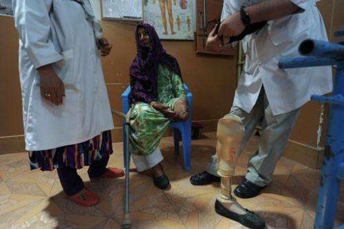 Afghan doctors in the city of Mazar-i-Sharif on May 23, 2012 with a woman who lost her leg from a landmine blast