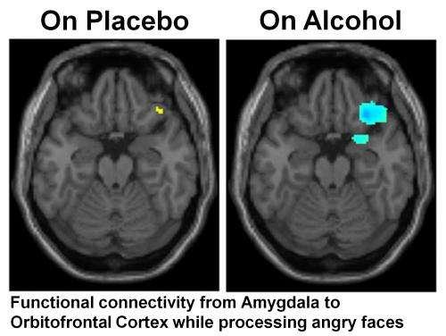 Alcohol breaks brain connections needed to process social cues