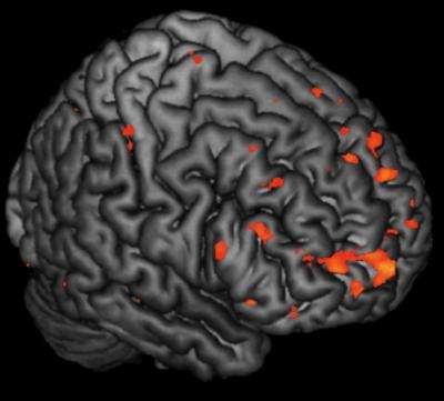 Alterations in brain activity in children at risk of schizophrenia predate onset of symptoms