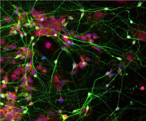 阿尔茨海默症、精神分裂症、自闭症现在有了新的研究工具:来自皮肤细胞的成熟脑细胞