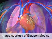 Ambrisentan not effective in idiopathic pulmonary fibrosis