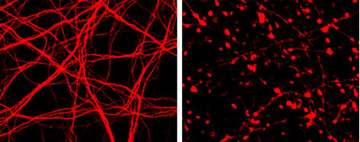 肉毒杆菌毒素的新突破:研究揭示了肉毒杆菌毒素如何影响神经元存活