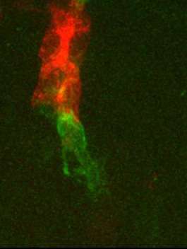 A study on cell migration provides insights into the movement of cancer cells
