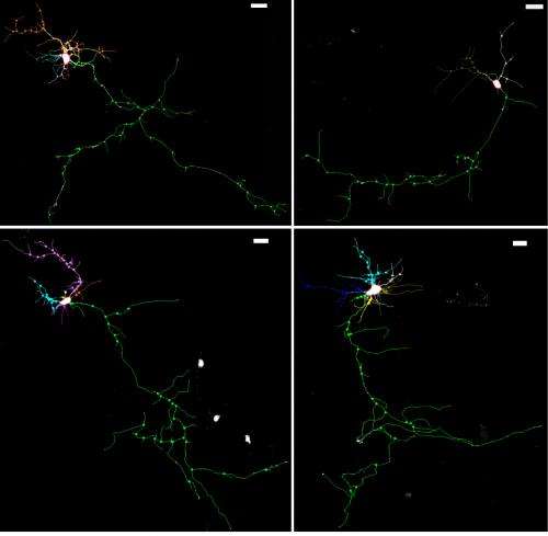 Autism gene stunts neurons, but growth can be restored, in mice