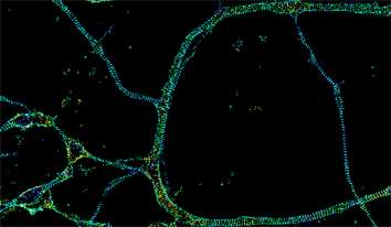 Axons' Unexpected Cytoskeleton Structure