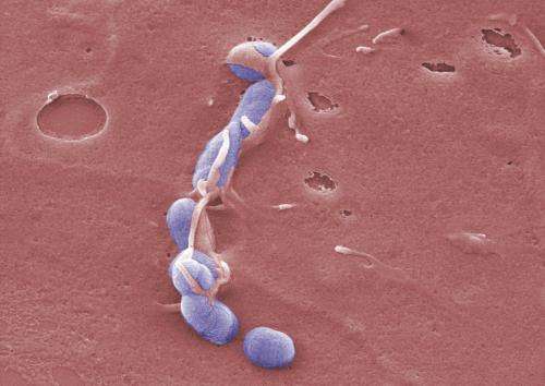 Bacterial toxin sets the course for infection